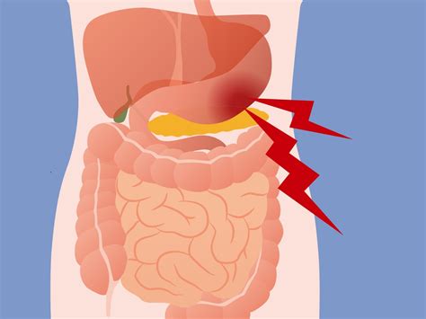 緊張するとお腹が痛くなる、それは心と体の密接な関係を示すサインか？